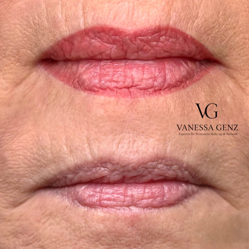 Lippen Vollschattierung (abgeheilt)