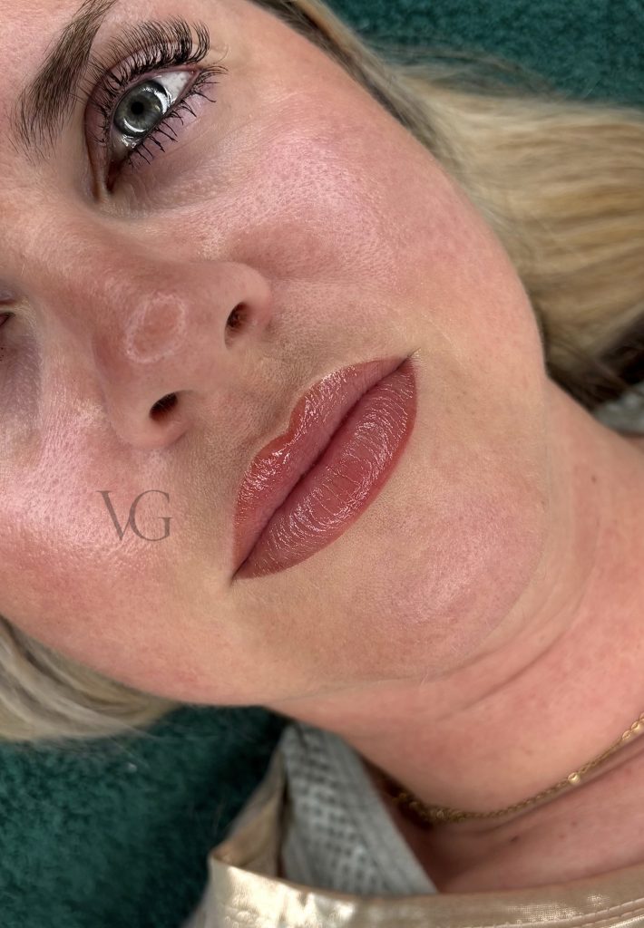 Lippen Teilschattierung abgeheilt