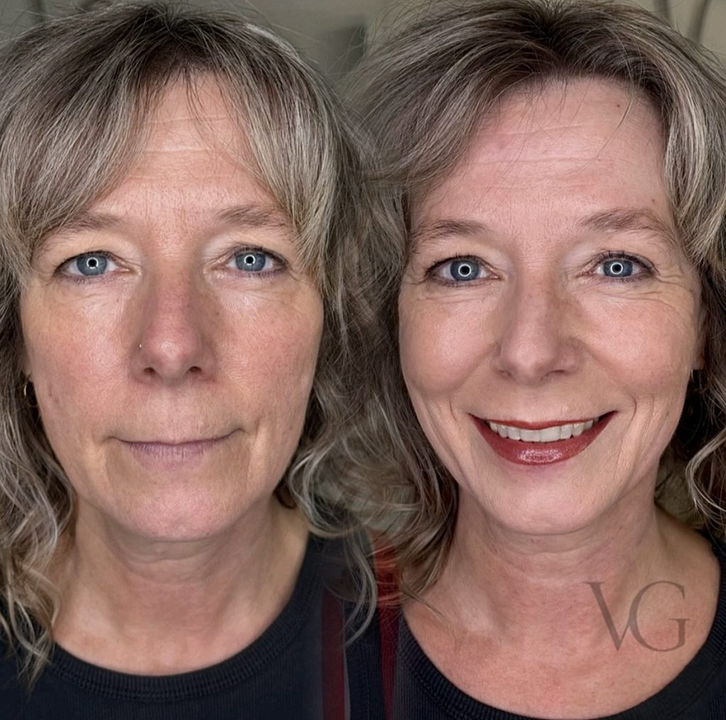 Lippenpigmentierung (links: vor der Behandlung, rechts: frisch pigmentiert)