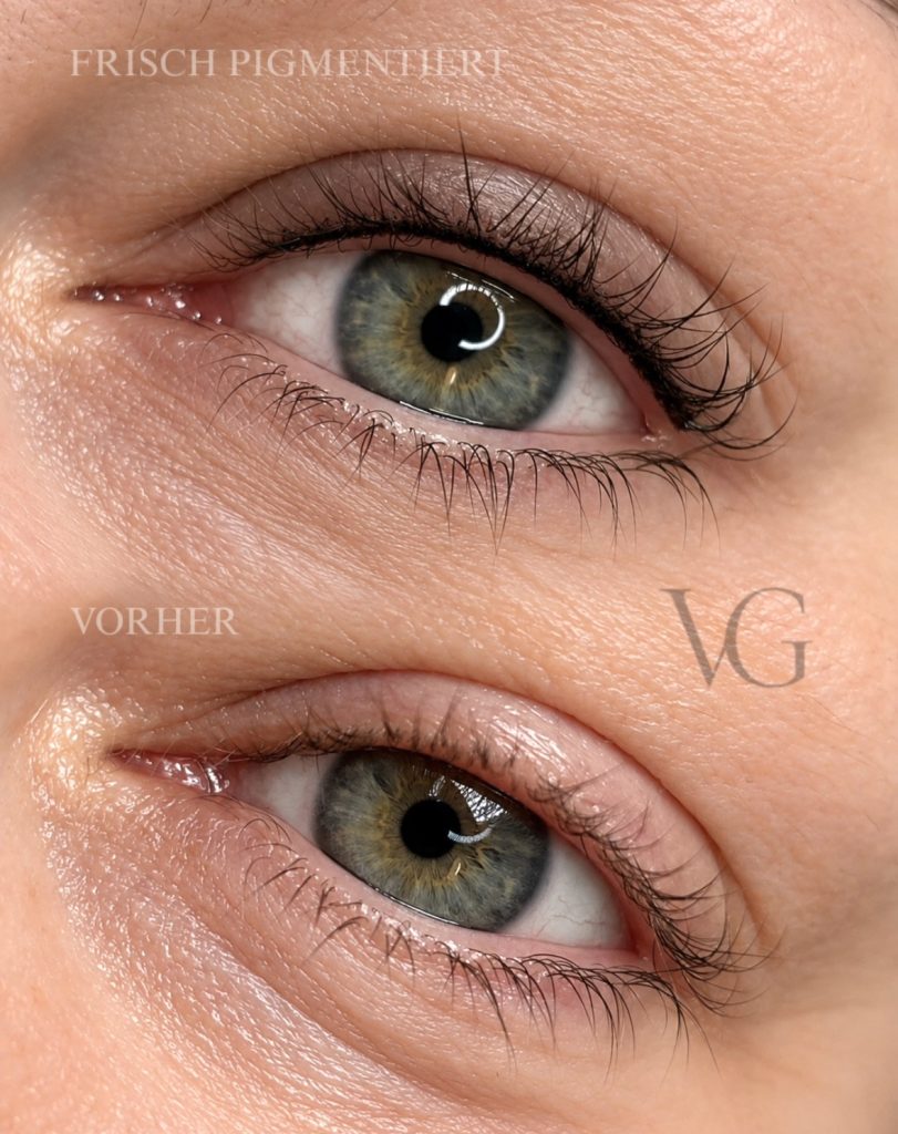 Wimpernkranzverdichtung (oben: frisch pigmentiert, unten: vor der Behandlung)