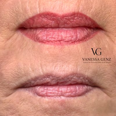 Vanessa_Genz-Expertinfürpmuundästhetik_Lippen
