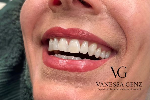 Vanessa_Genz-Expertinfürpmuundästhetik_Lippen1